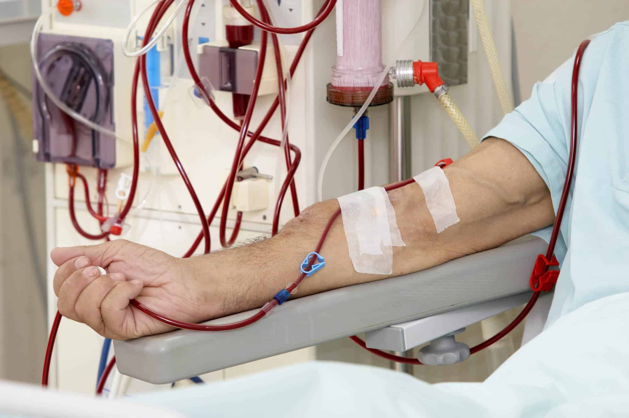 Avoid Driving After Dialysis Treatments